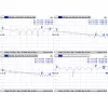 Kabel MMCX naar RPSMA/ACMMCXRPSMA Mikrotik