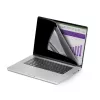StarTech.com 16 inch MacBook Pro 21/23 laptop-privacyscreen, verwijderbaar en omkeerbaar anti-glare privacyscreenfilter, magnetische laptop-schermbescherming met 51% blauwlichtreductie