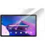 eSTUFF ES517011 tablet beeldschermbeschermfolie heldere beeldschermbeschermfolie Microsoft 1 stk.