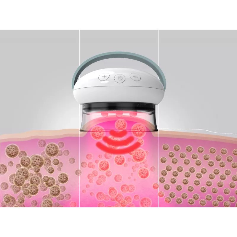 HoMedics Smoothee IR massager voor benen wit 4 koppen op batterijen