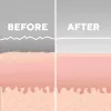 HoMedics MD-1000-EU2 huidverzorgingsapparaat huidvacuüm-microdermabrasie wit