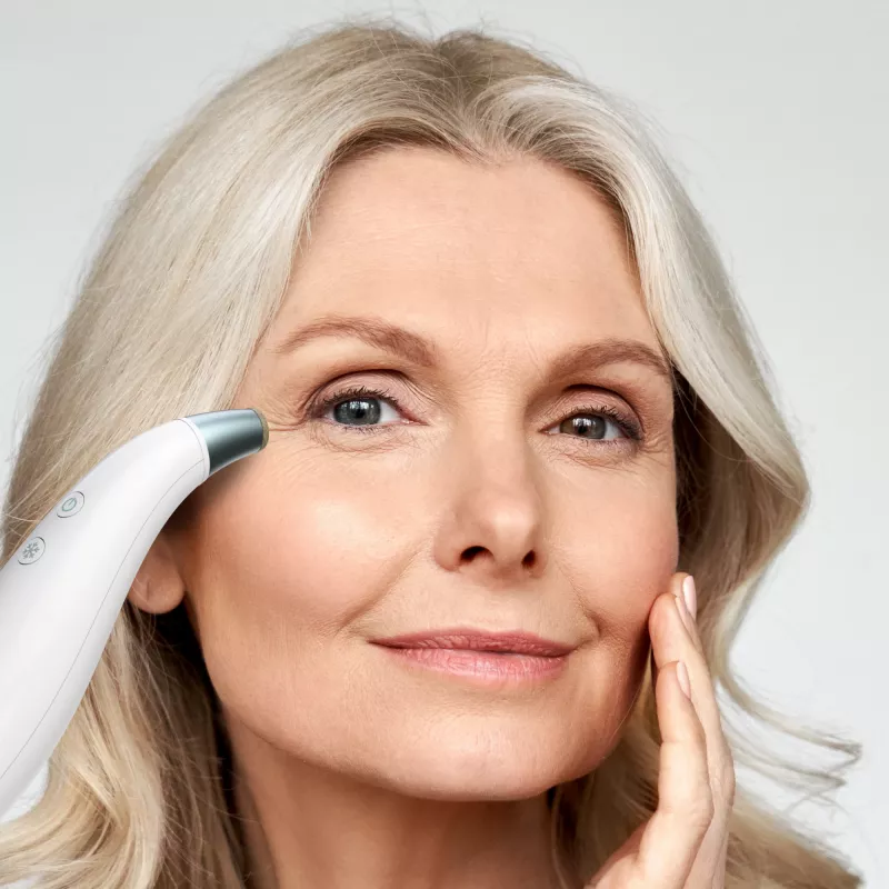 HoMedics MD-1000-EU2 huidverzorgingsapparaat huidvacuüm-microdermabrasie wit