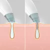 HoMedics FAC-HY100 huidverzorgingsapparaat hydradermabrasion-reiniger transparant, wit