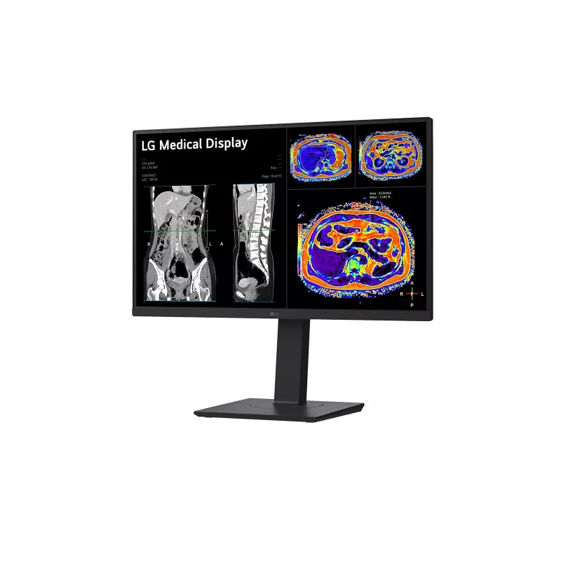LG 27HS713C-B computermonitor 68,6 cm (27 inch) 3840 x 2160 pixel 4K Ultra HD LED zwart