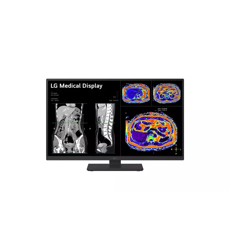 LG 27HS713C-B computermonitor 68,6 cm (27 inch) 3840 x 2160 pixel 4K Ultra HD LED zwart