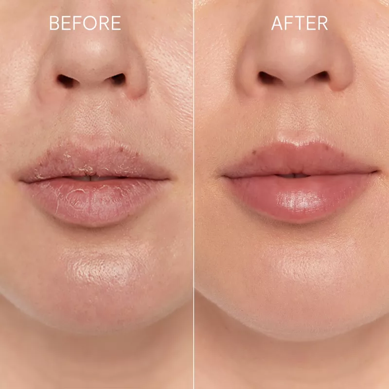 GLOV Scrubex Lip Exfoliating Mitt - 2-pack | Zachte microvezel lippenpeeling voor gladde lippen