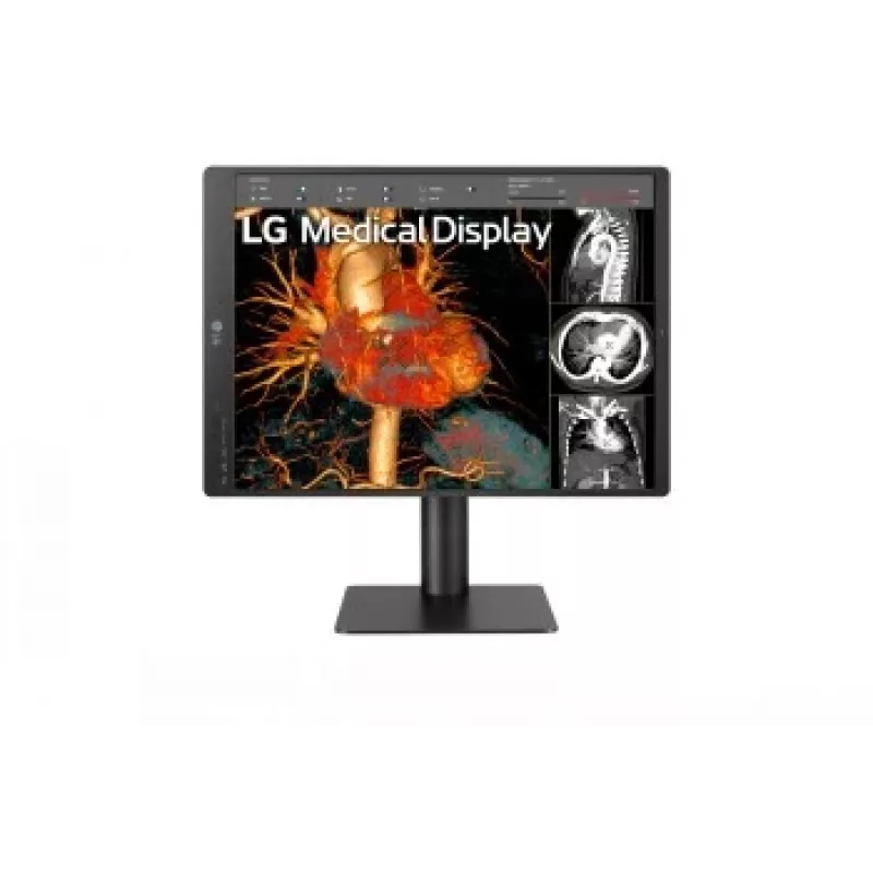 LG 21,3 inch 3MP IPS Diagnosemonitor 21HQ513D-M