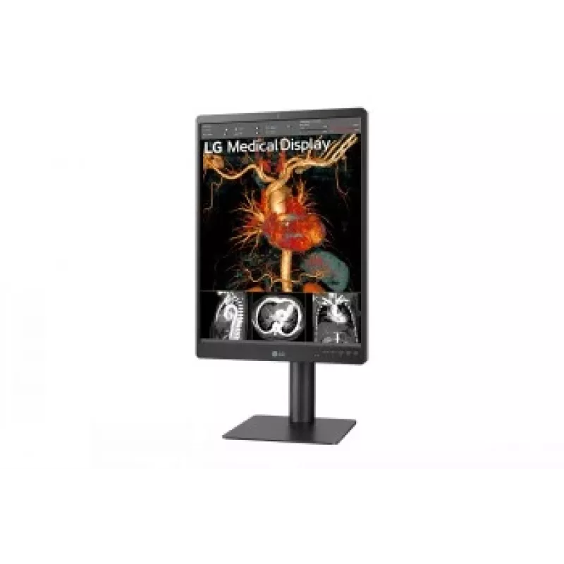 LG 21,3 inch 3MP IPS Diagnosemonitor 21HQ513D-M